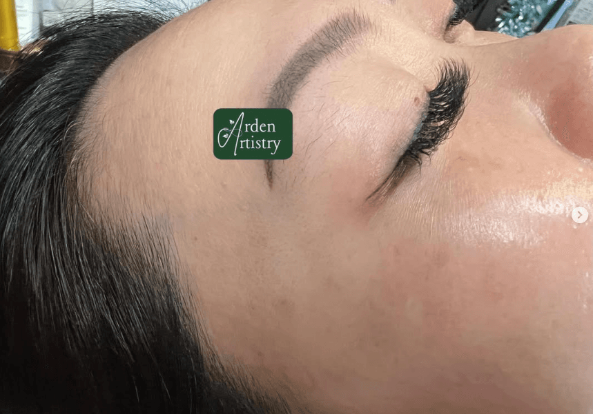 Refined Lashline Definition